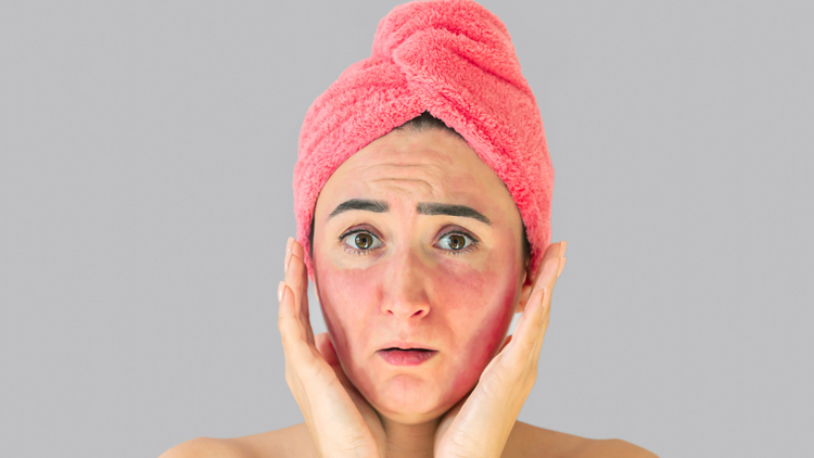 IRRITATED / SENSITIVE SKIN