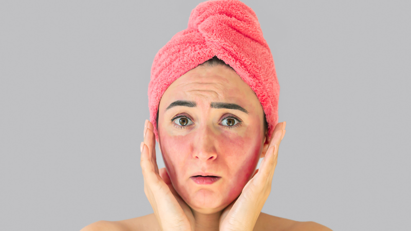 IRRITATED / SENSITIVE SKIN